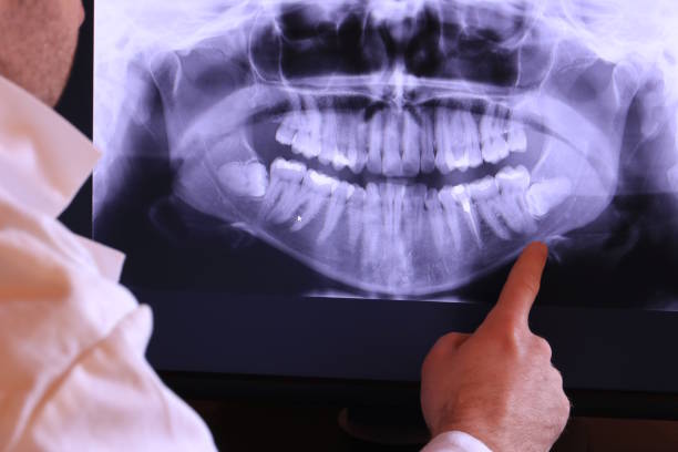 Best Broken or Cracked Tooth Emergency Dentist in Mars Hill, NC